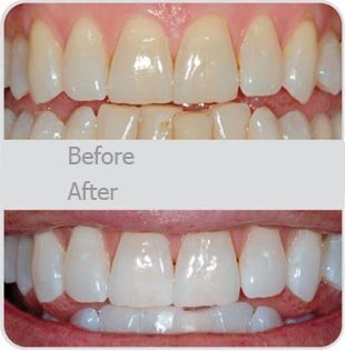[Before_After]